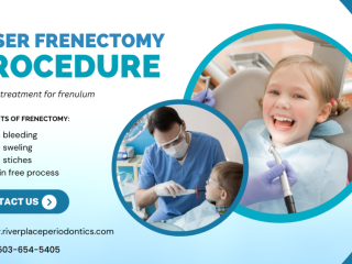 What is a Frenectomy Treatment ? Can Frenectomy Improve Your Smile ?