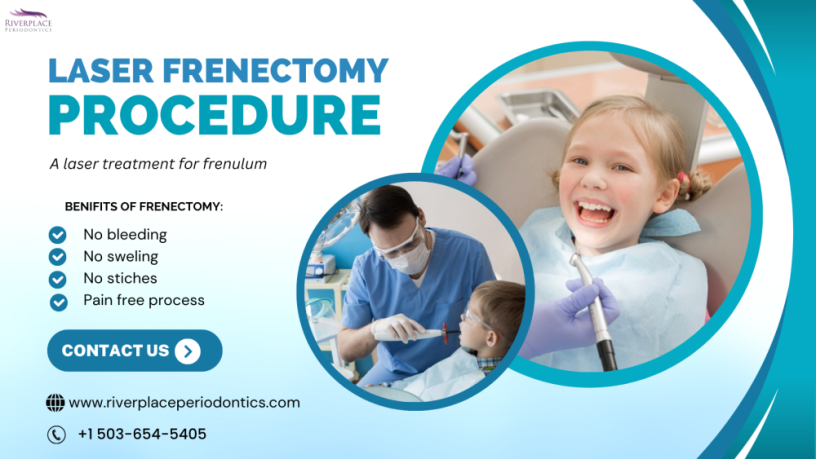 what-is-a-frenectomy-treatment-can-frenectomy-improve-your-smile-big-0