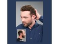 mens-non-surgical-hair-replacement-in-yorba-linda-small-0