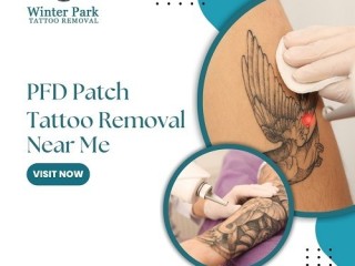 PFD Patch Tattoo Removal Near Me - Faster Healing