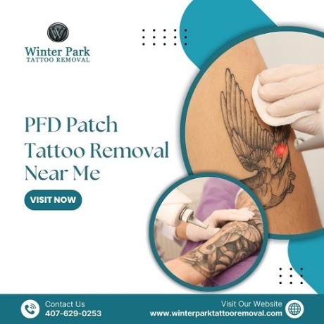 pfd-patch-tattoo-removal-near-me-faster-healing-big-0