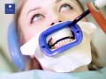 affordable-teeth-whitening-brighten-your-smile-today-small-0