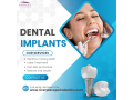 are-dental-implants-safe-small-0