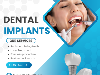 Are Dental Implants Safe?