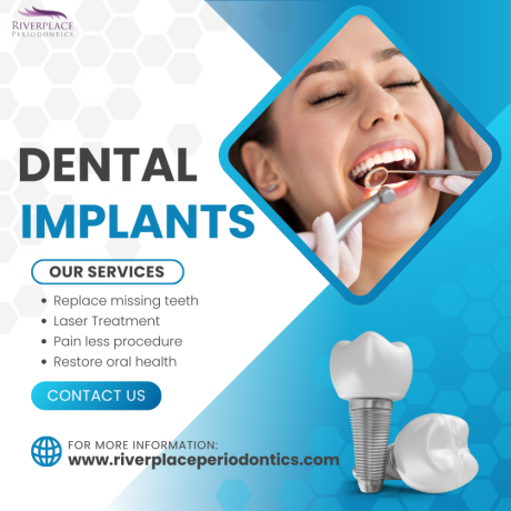 are-dental-implants-safe-big-0