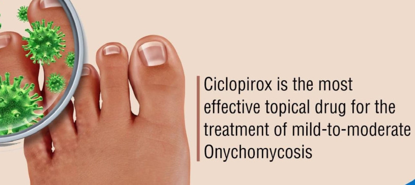 ciclopirox-nail-lacquer-for-fungal-skin-infections-big-0