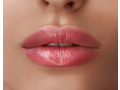 lip-augmentation-dallas-the-brow-project-small-0
